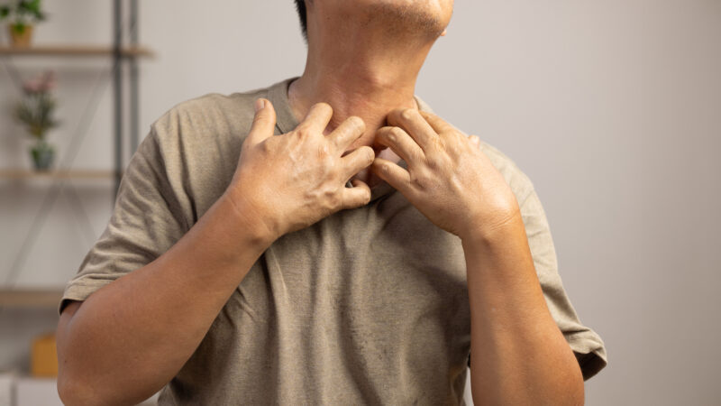 DoctorSpeak: Saving your skin from cold and pollution