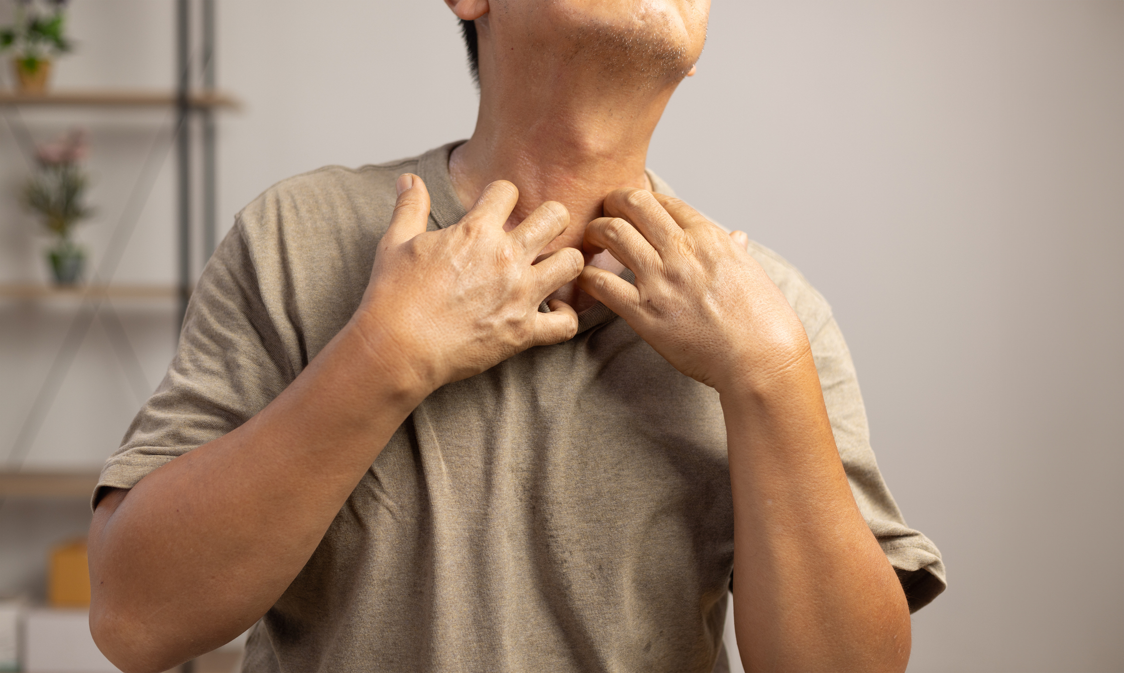 DoctorSpeak: Saving your skin from cold and pollution